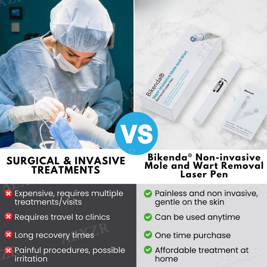 Bikenda® Non-Invasive Mole and Wart Removal Laser Pen Pro