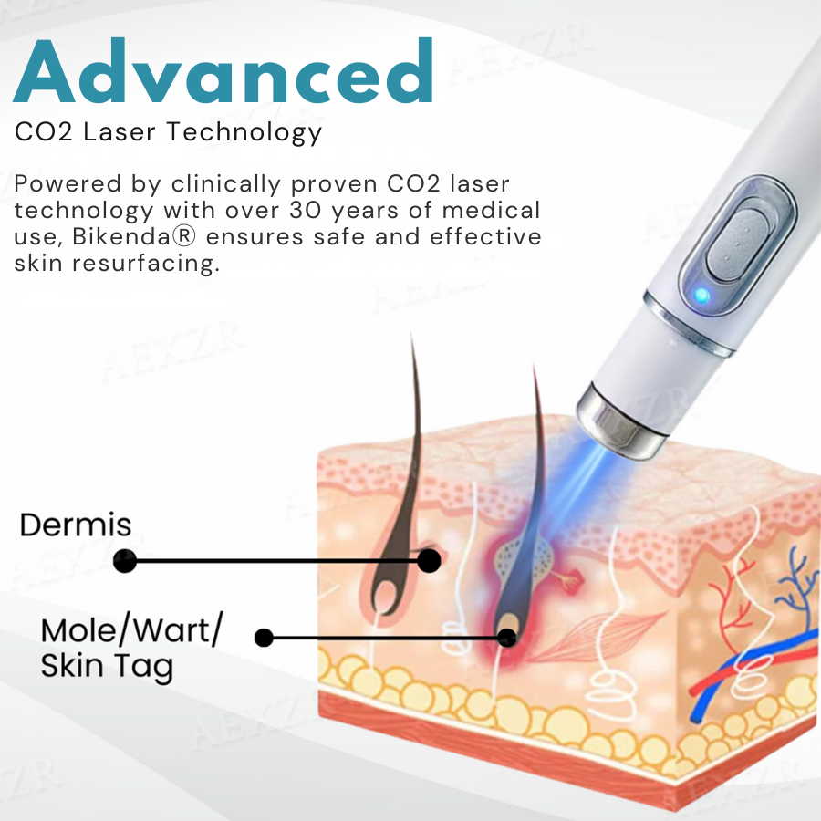 Bikenda® Non-Invasive Mole and Wart Removal Laser Pen Pro