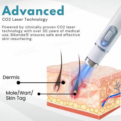 Bikenda® Non-Invasive Mole and Wart Removal Laser Pen Pro